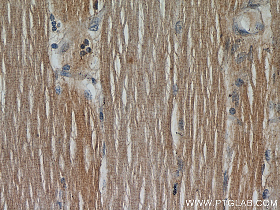 Immunohistochemistry (IHC) staining of human skeletal muscle tissue using CFLAR/FLIP Polyclonal antibody (10394-1-AP)