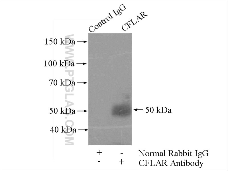 Immunoprecipitation (IP) experiment of Jurkat cells using CFLAR/FLIP Polyclonal antibody (10394-1-AP)