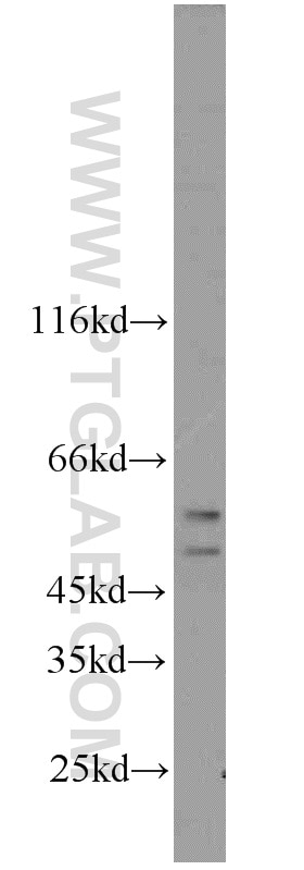 Western Blot (WB) analysis of HeLa cells using CFLAR/FLIP Polyclonal antibody (10394-1-AP)
