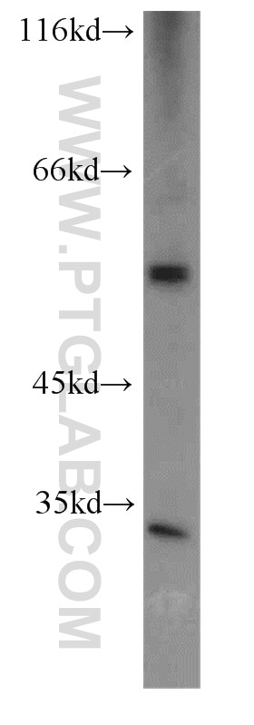 Western Blot (WB) analysis of Jurkat cells using CFLAR/FLIP Polyclonal antibody (10394-1-AP)
