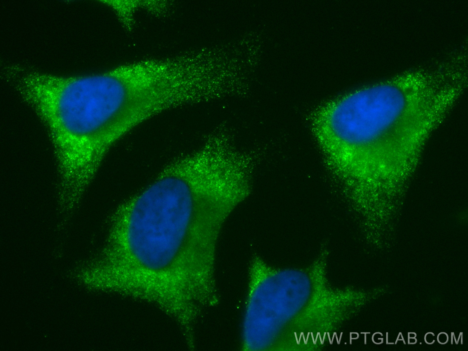 Immunofluorescence (IF) / fluorescent staining of HeLa cells using CoraLite® Plus 488-conjugated CFLAR/FLIP Polyclona (CL488-10394)