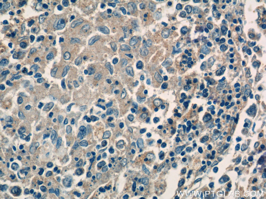 Immunohistochemistry (IHC) staining of human spleen tissue using CFP Polyclonal antibody (17192-1-AP)