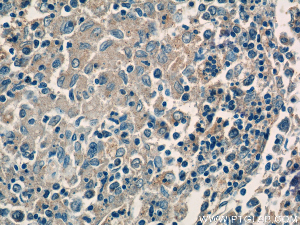 IHC staining of human spleen using 17192-1-AP