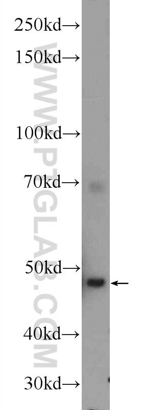 Western Blot (WB) analysis of Jurkat cells using CFP Polyclonal antibody (17192-1-AP)