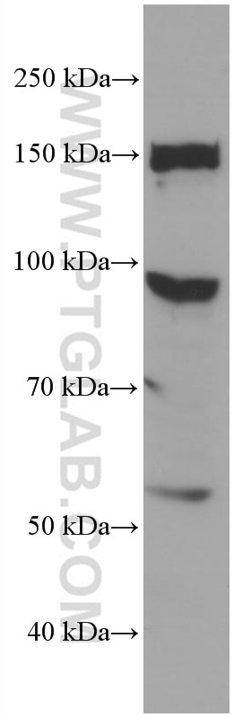 Western Blot (WB) analysis of Jurkat cells using CFP Monoclonal antibody (66788-1-Ig)