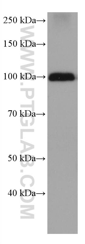 Western Blot (WB) analysis of human plasma using CFP Monoclonal antibody (66788-1-Ig)