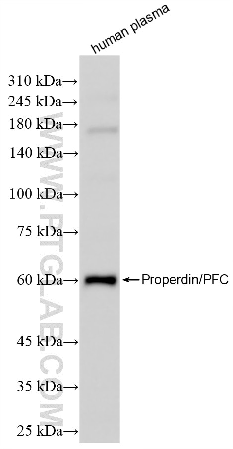 Western Blot (WB) analysis of human plasma using CFP Recombinant antibody (85999-1-RR)
