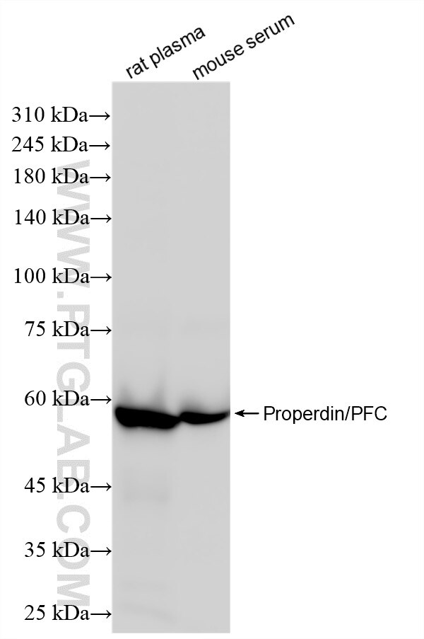 Western Blot (WB) analysis of various lysates using CFP Recombinant antibody (85999-1-RR)