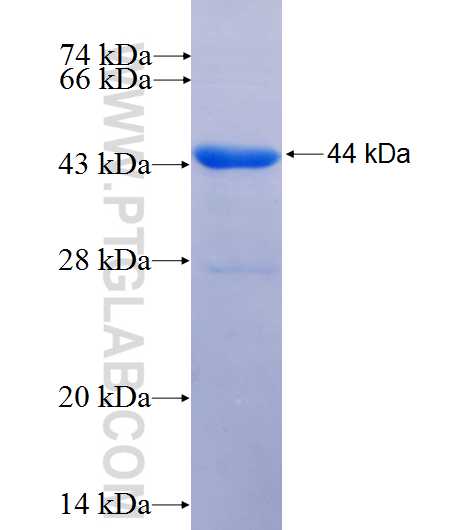 CFP fusion protein Ag9798 SDS-PAGE