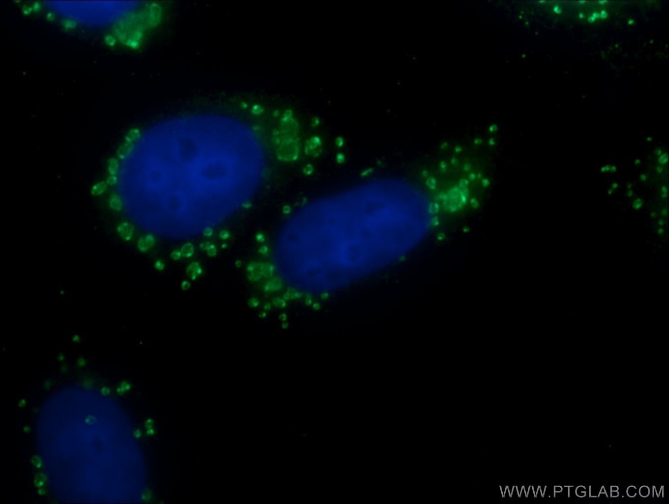 Immunofluorescence (IF) / fluorescent staining of HepG2 cells using CFTR Polyclonal antibody (20738-1-AP)