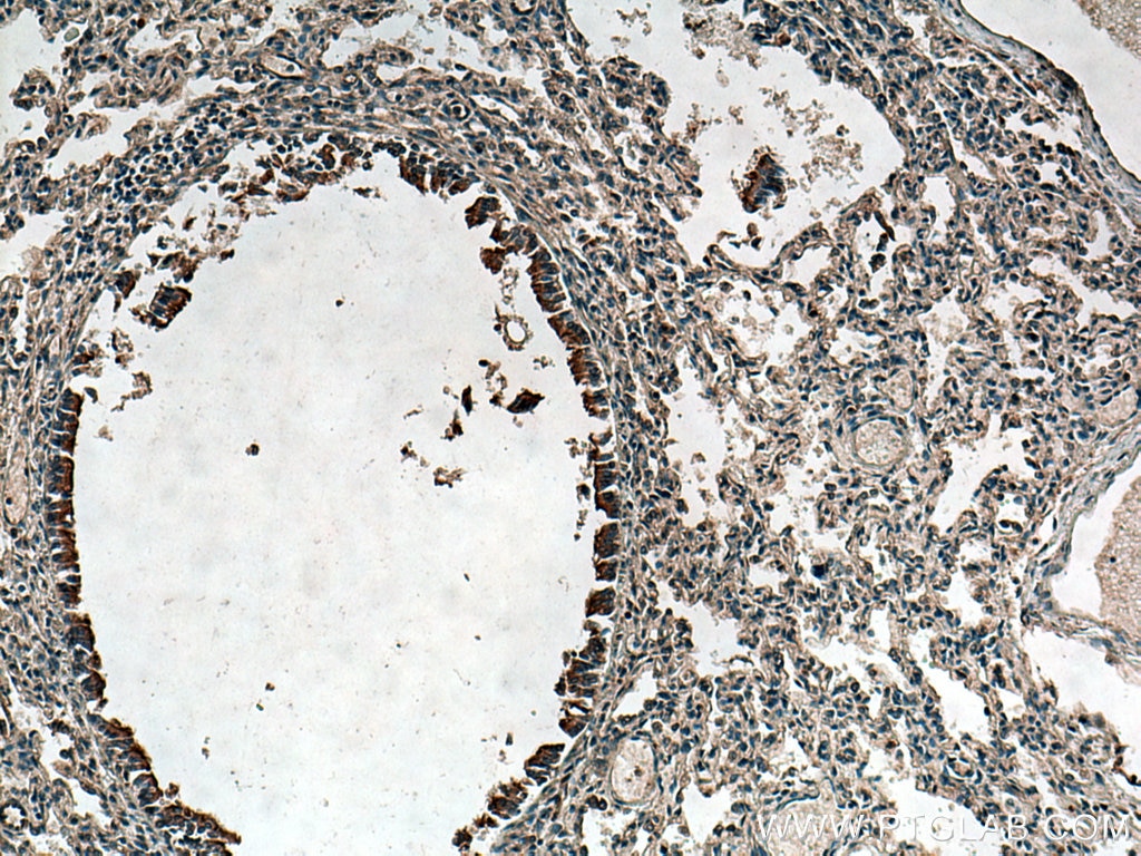 Immunohistochemistry (IHC) staining of human lung tissue using CFTR Polyclonal antibody (20738-1-AP)