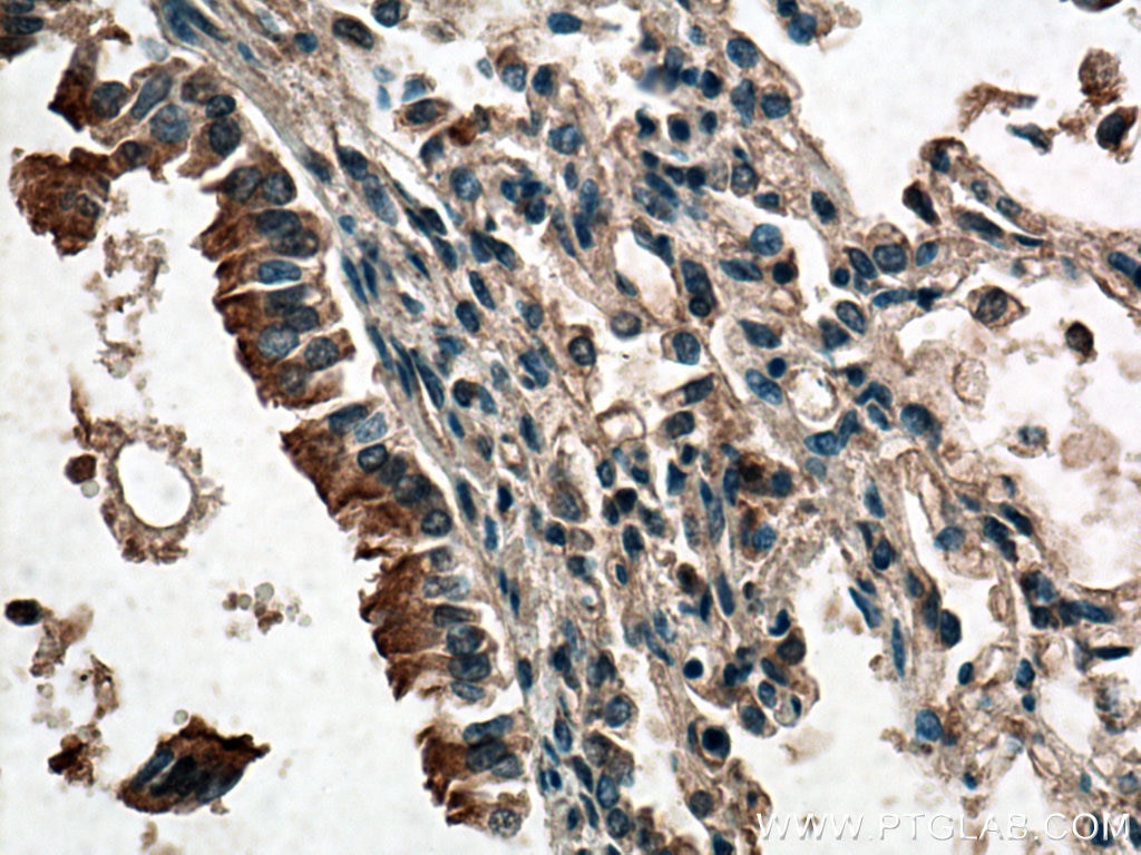 Immunohistochemistry (IHC) staining of human lung tissue using CFTR Polyclonal antibody (20738-1-AP)