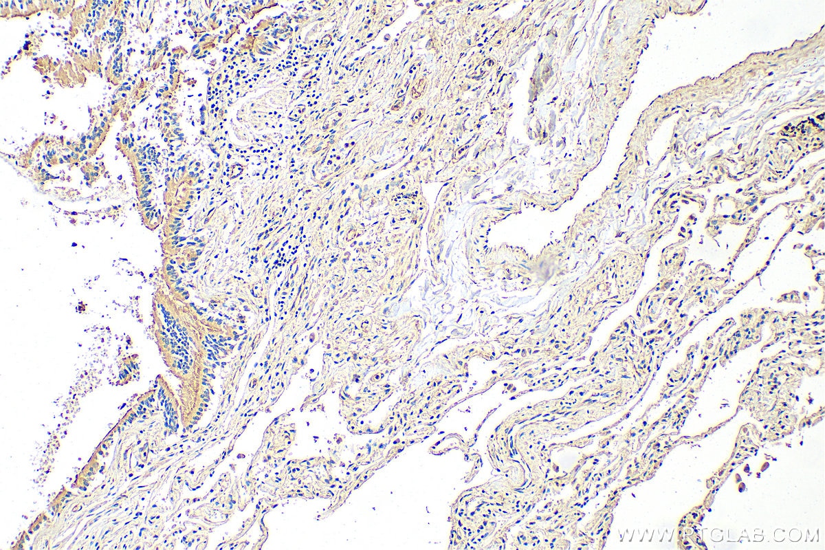 Immunohistochemistry (IHC) staining of human lung tissue using CFTR Polyclonal antibody (20738-1-AP)