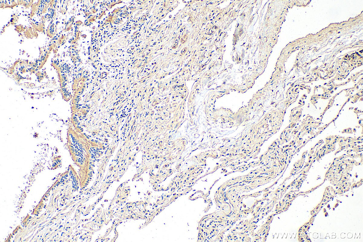 IHC staining of human lung using 20738-1-AP