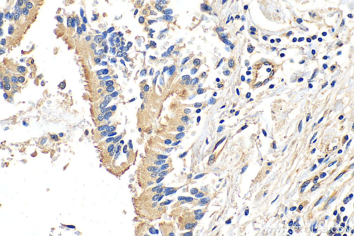 IHC staining of human lung using 20738-1-AP