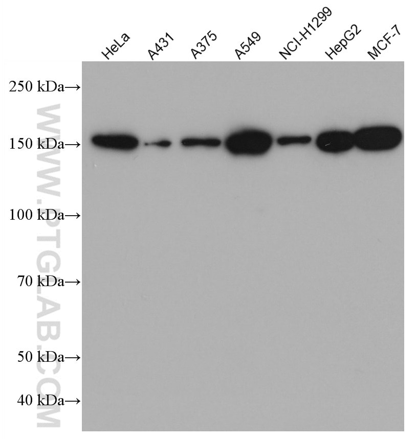 Western Blot (WB) analysis of various lysates using CFTR Monoclonal antibody (66928-1-Ig)