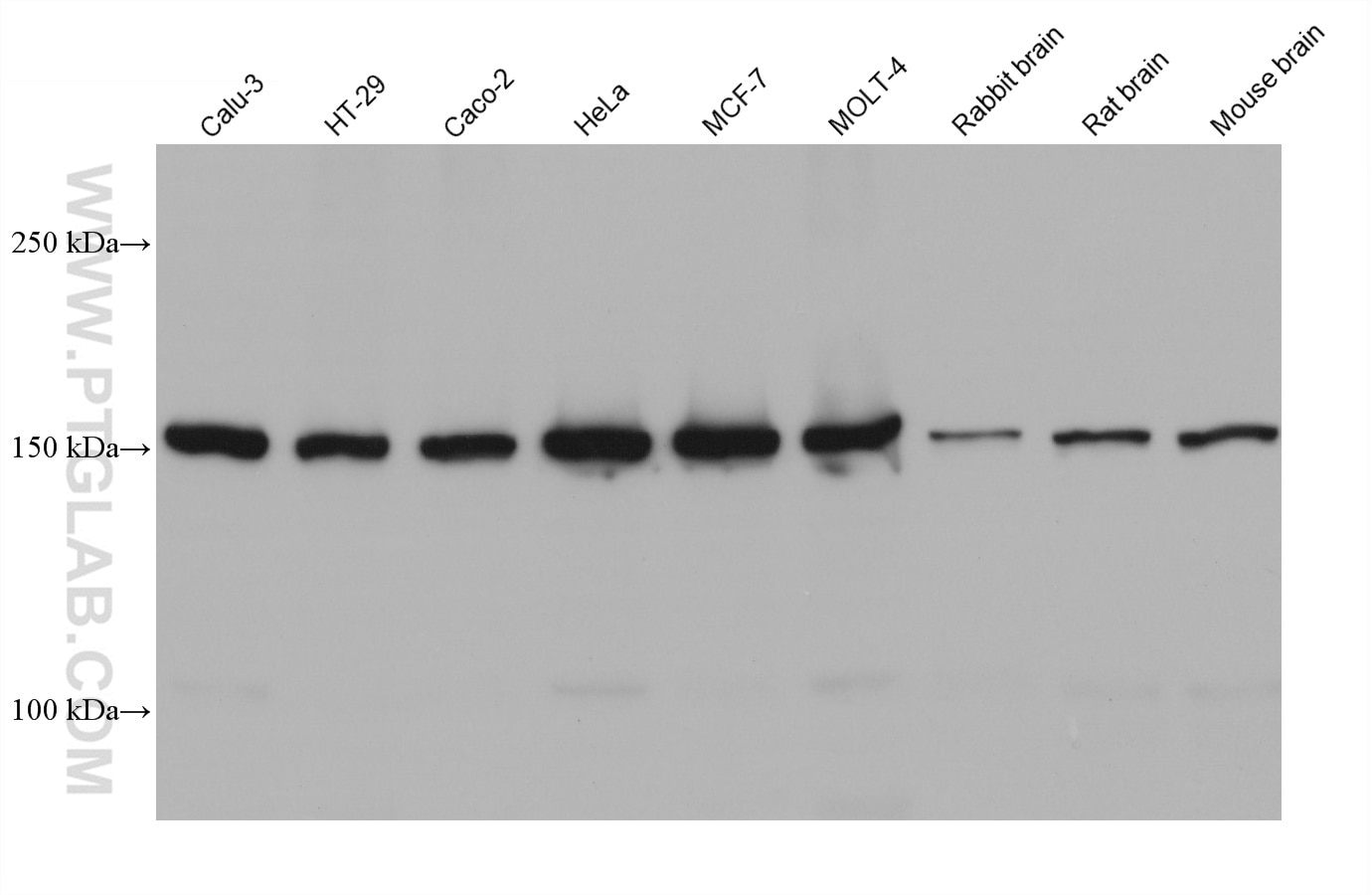 Western Blot (WB) analysis of various lysates using CFTR Monoclonal antibody (66928-1-Ig)