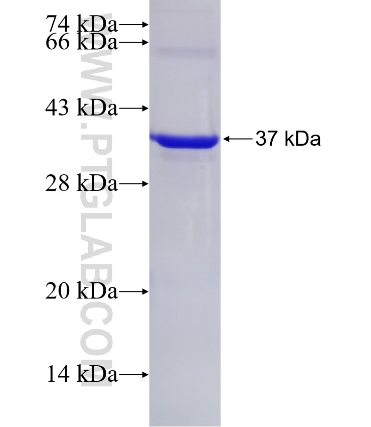 CFTR fusion protein Ag27795 SDS-PAGE