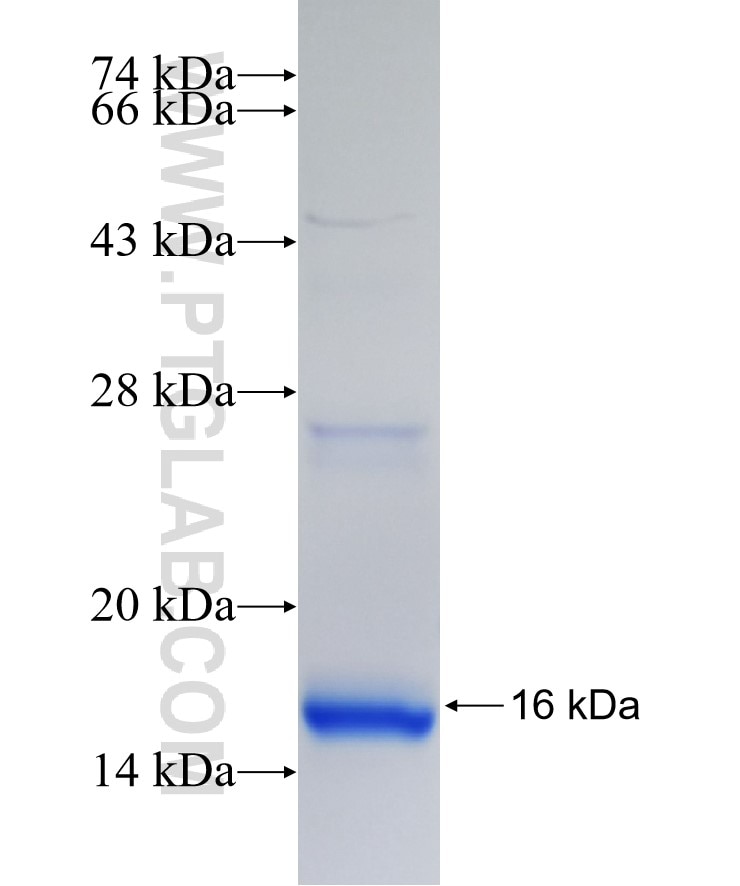 CFTR fusion protein Ag27810 SDS-PAGE