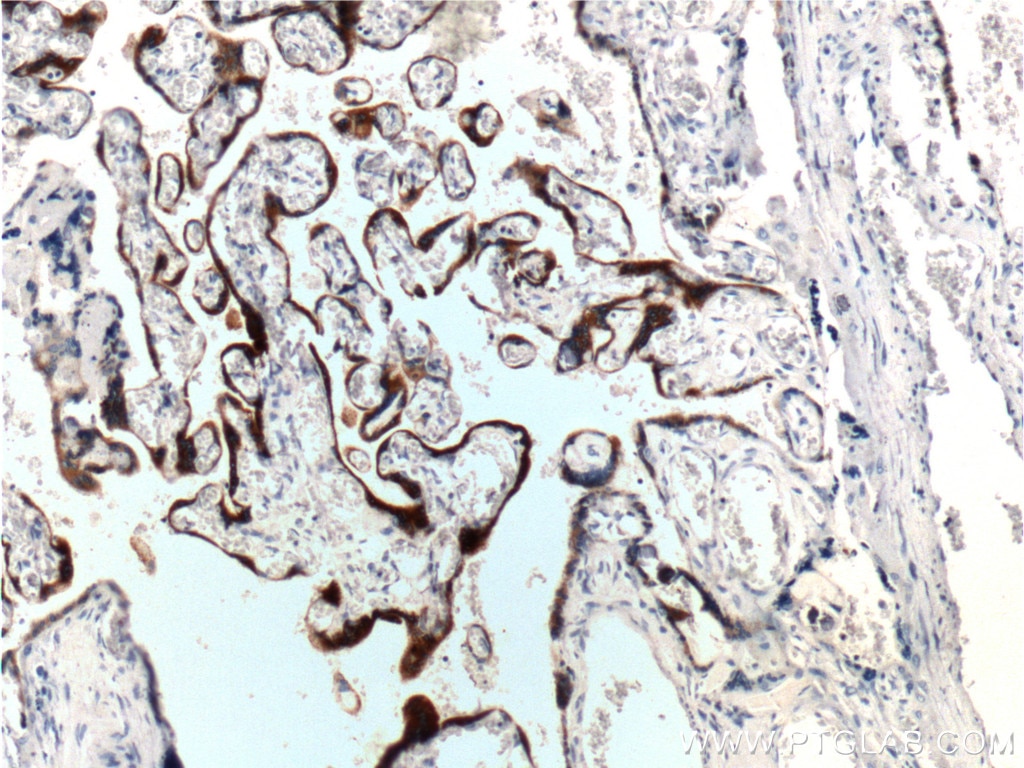 Immunohistochemistry (IHC) staining of human placenta tissue using hCG Beta Polyclonal antibody (11615-1-AP)