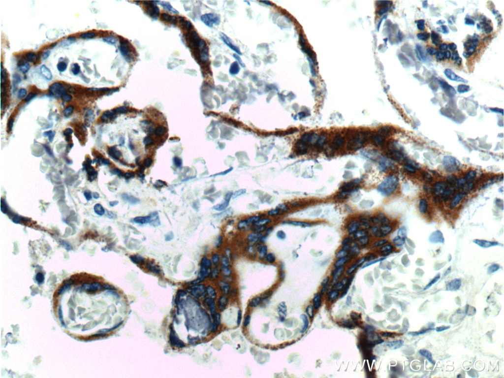 Immunohistochemistry (IHC) staining of human placenta tissue using hCG Beta Polyclonal antibody (11615-1-AP)