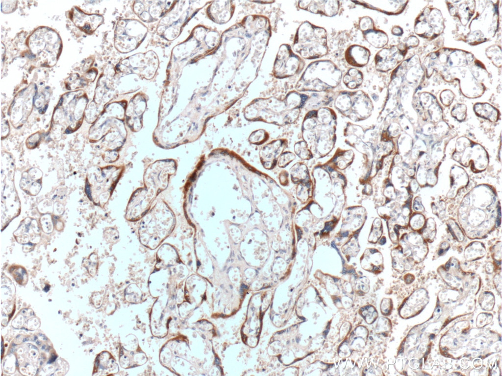 IHC staining of human placenta using 11615-1-AP