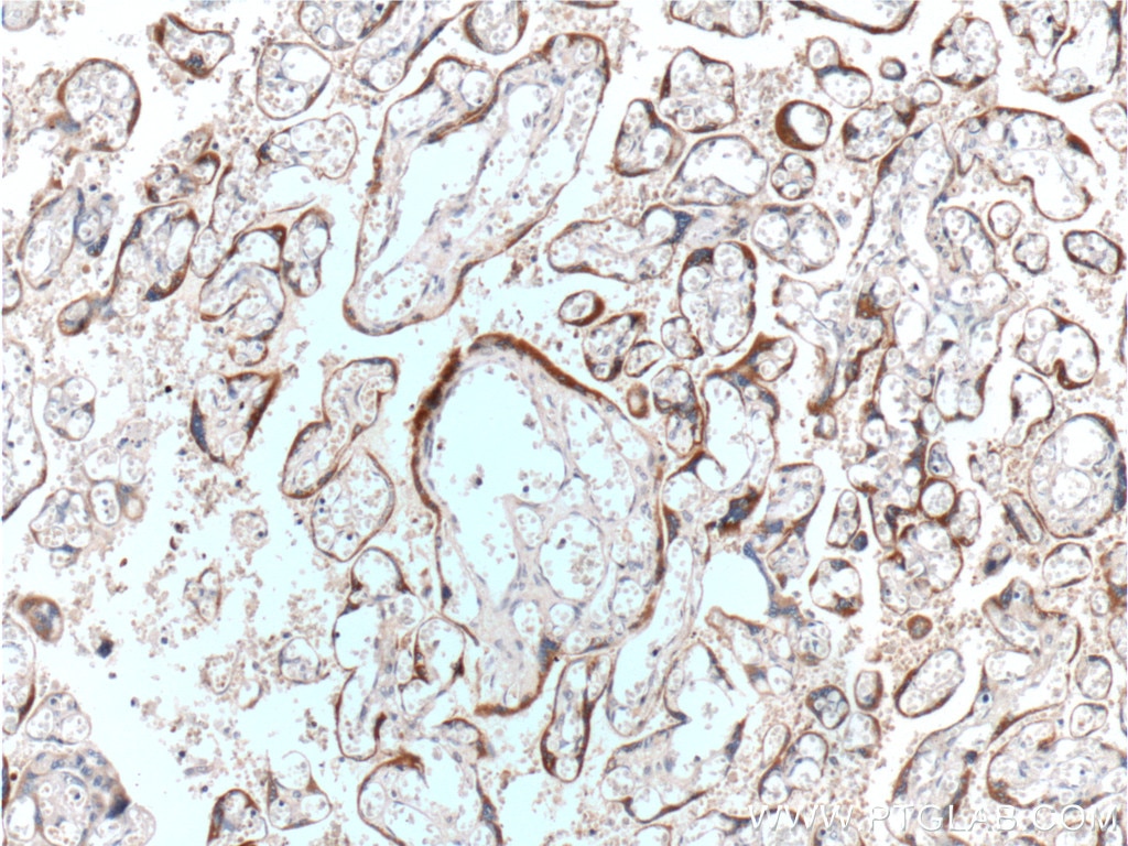 Immunohistochemistry (IHC) staining of human placenta tissue using hCG Beta Polyclonal antibody (11615-1-AP)
