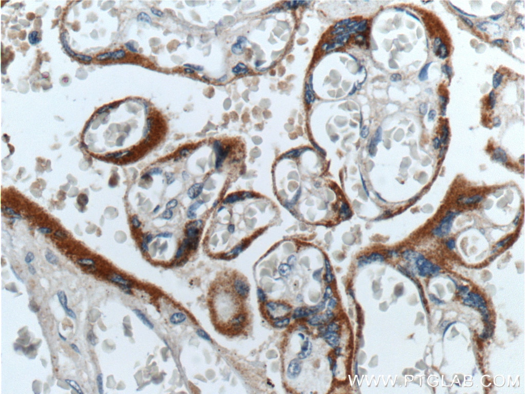 Immunohistochemistry (IHC) staining of human placenta tissue using hCG Beta Polyclonal antibody (11615-1-AP)