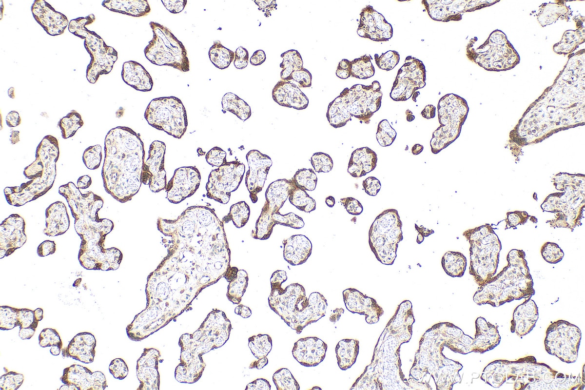 Immunohistochemical analysis of paraffin-embedded human placenta tissue slide using 11615-1-AP (hCG Beta antibody) at dilution of 1:1000 (under 10x lens). Heat mediated antigen retrieval with Tris-EDTA buffer (pH 9.0). Immunohistochemistry (IHC) staining of human placenta tissue using hCG Beta Polyclonal antibody (11615-1-AP)