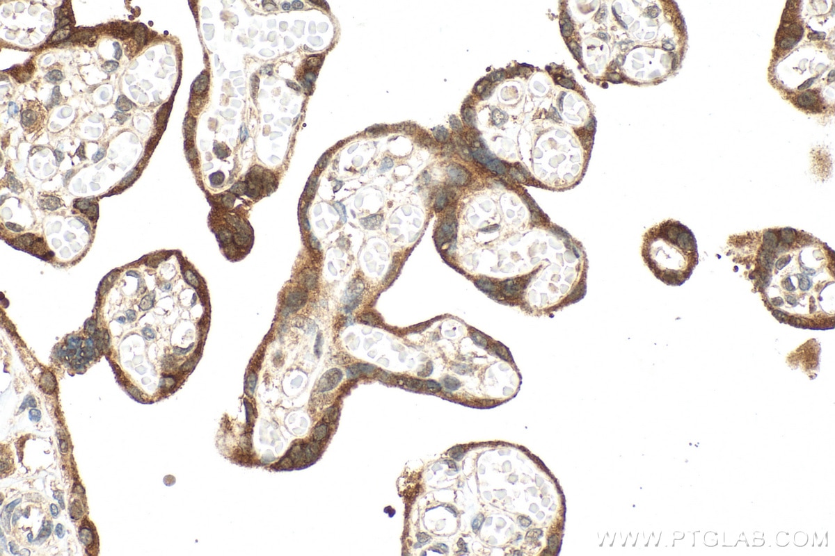 Immunohistochemistry (IHC) staining of human placenta tissue using hCG Beta Polyclonal antibody (11615-1-AP)