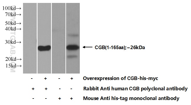 hCG Beta Polyclonal antibody