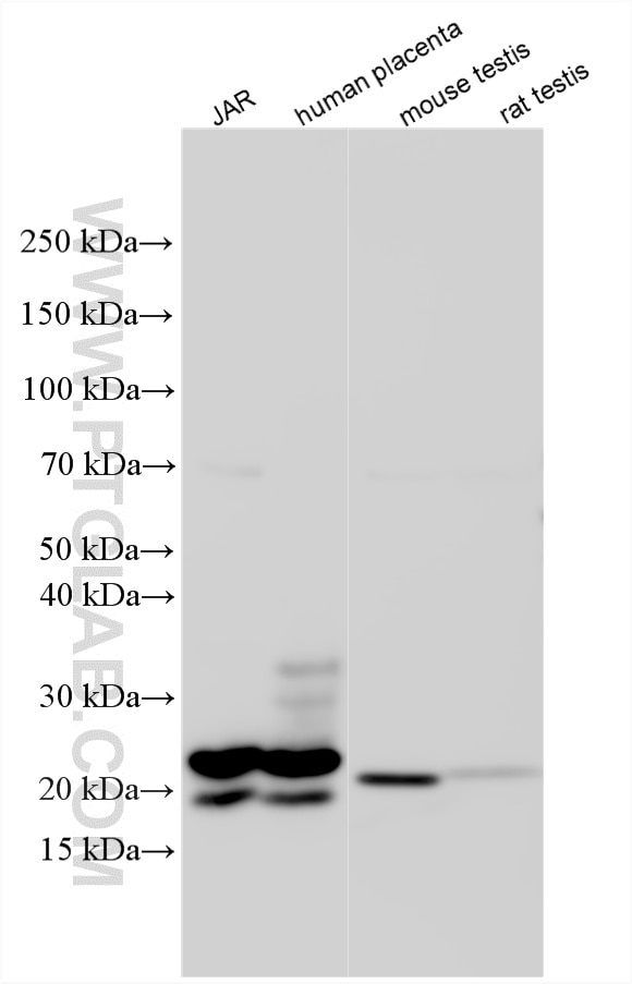 Various lysates were subjected to SDS PAGE followed by western blot with 11615-1-AP (hCG Beta antibody) at dilution of 1:6000 incubated at room temperature for 1.5 hours. Western Blot (WB) analysis of various lysates using hCG Beta Polyclonal antibody (11615-1-AP)