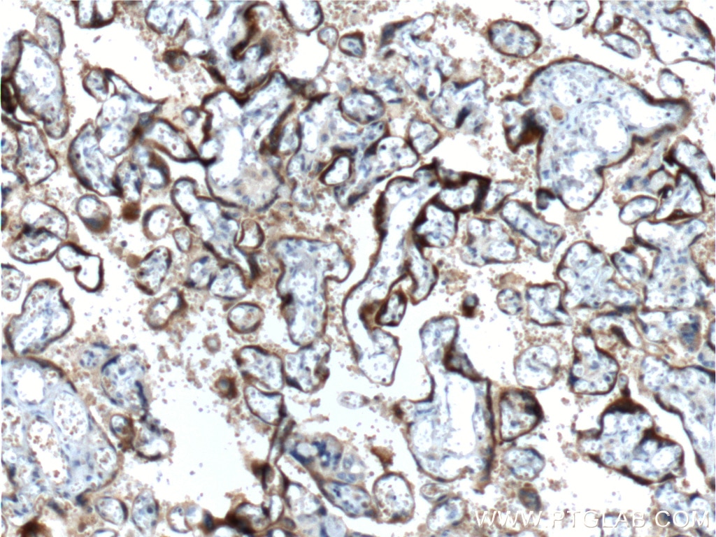 Immunohistochemistry (IHC) staining of human placenta tissue using hCG Beta Monoclonal antibody (60334-1-Ig)