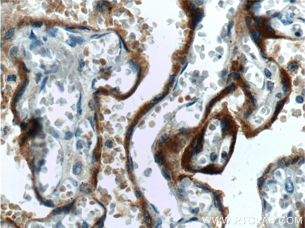 Immunohistochemistry (IHC) staining of human placenta tissue using hCG Beta Monoclonal antibody (60334-1-Ig)