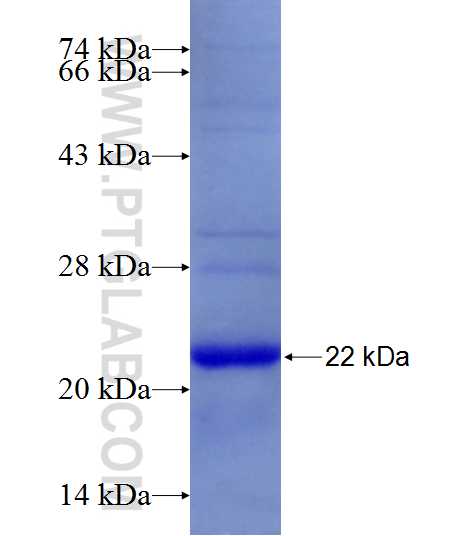 CGB,hCG fusion protein Ag18824 SDS-PAGE