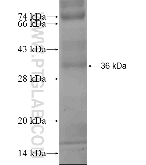 CGB,hCG fusion protein Ag18917 SDS-PAGE