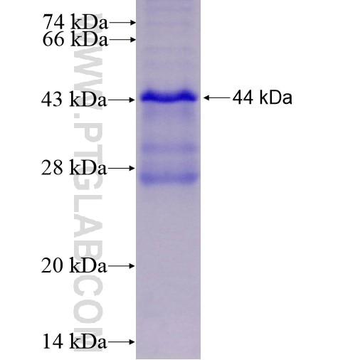CGB,hCG fusion protein Ag2191 SDS-PAGE