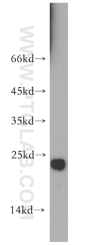 Western Blot (WB) analysis of K-562 cells using CGGBP1 Polyclonal antibody (10716-1-AP)