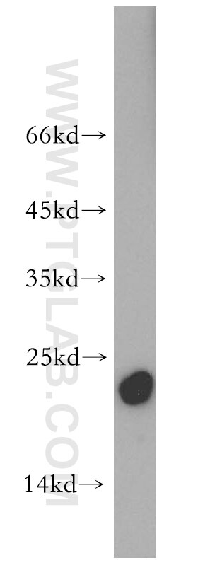 Western Blot (WB) analysis of Raji cells using CGGBP1 Polyclonal antibody (10716-1-AP)