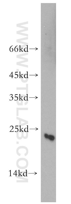 Western Blot (WB) analysis of HL-60 cells using CGGBP1 Polyclonal antibody (10716-1-AP)