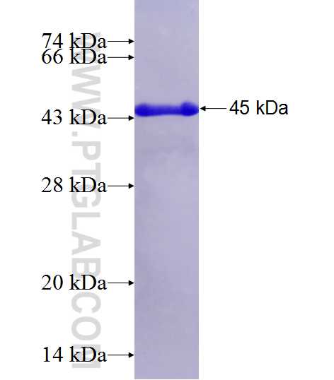 CGGBP1 fusion protein Ag1129 SDS-PAGE