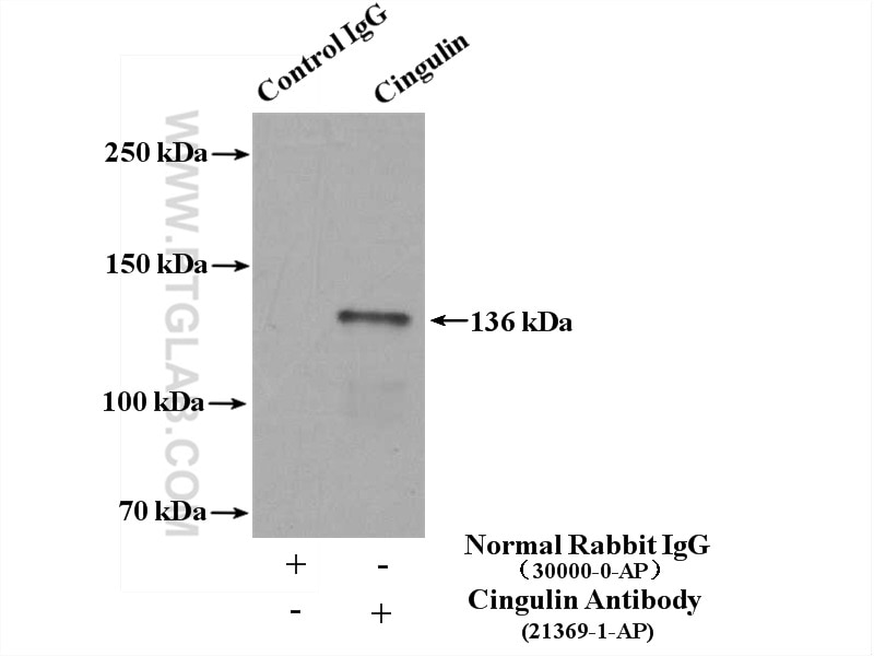 Immunoprecipitation (IP) experiment of mouse kidney tissue using Cingulin Polyclonal antibody (21369-1-AP)