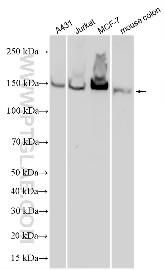 Western Blot (WB) analysis of various lysates using Cingulin Polyclonal antibody (21369-1-AP)