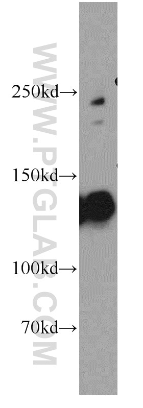 Western Blot (WB) analysis of mouse kidney tissue using Cingulin Polyclonal antibody (21369-1-AP)