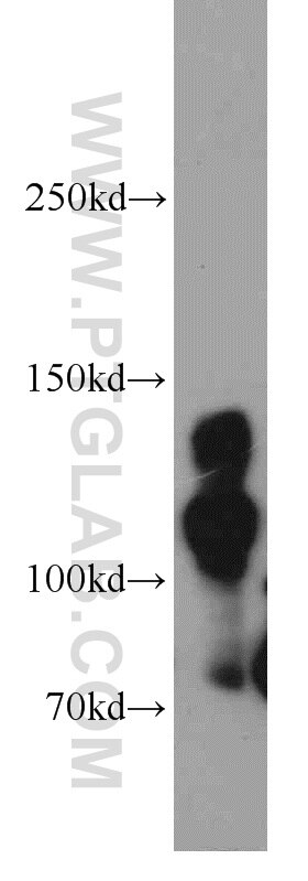 Western Blot (WB) analysis of mouse small intestine tissue using Cingulin Polyclonal antibody (21369-1-AP)