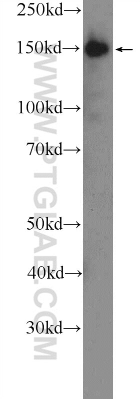 Western Blot (WB) analysis of HEK-293 cells using CGNL1 Polyclonal antibody (18031-1-AP)