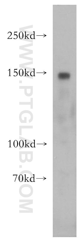 Western Blot (WB) analysis of NIH/3T3 cells using CGNL1 Polyclonal antibody (18031-1-AP)