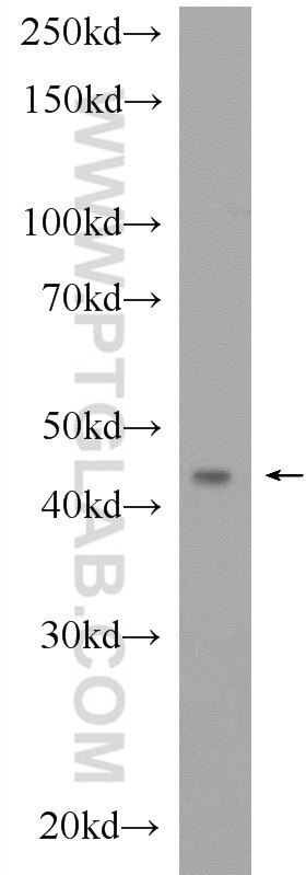 Western Blot (WB) analysis of rat kidney tissue using CGRRF1 Polyclonal antibody (16101-1-AP)