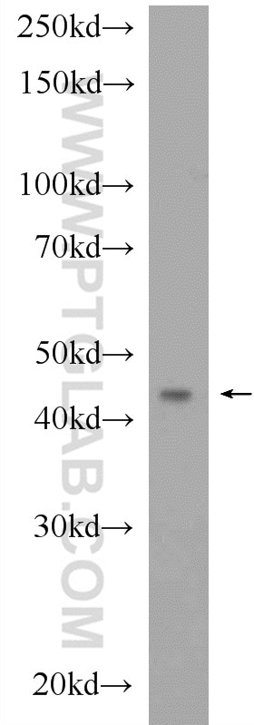 WB analysis of rat kidney using 16101-1-AP