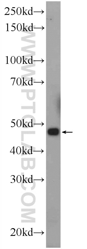 Western Blot (WB) analysis of rat kidney tissue using CGRRF1 Polyclonal antibody (16101-1-AP)